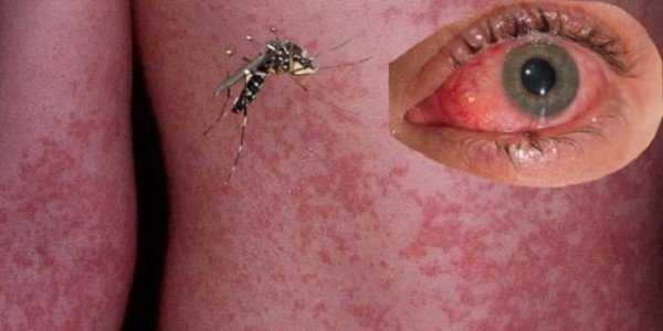Как выглядит и чем опасен малярийный комар