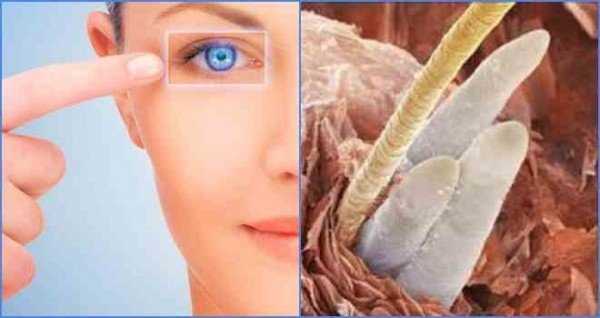 Симптомы и лечение глазного клеща