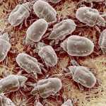 Фото пылевых, постельных домашних клещей под микроскопом, признаки наличия паразитов в доме